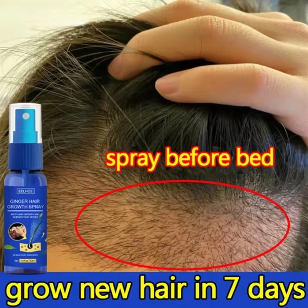 Hair Care For Hair Growth - Fast Ginger Hair Growth Spray Roots