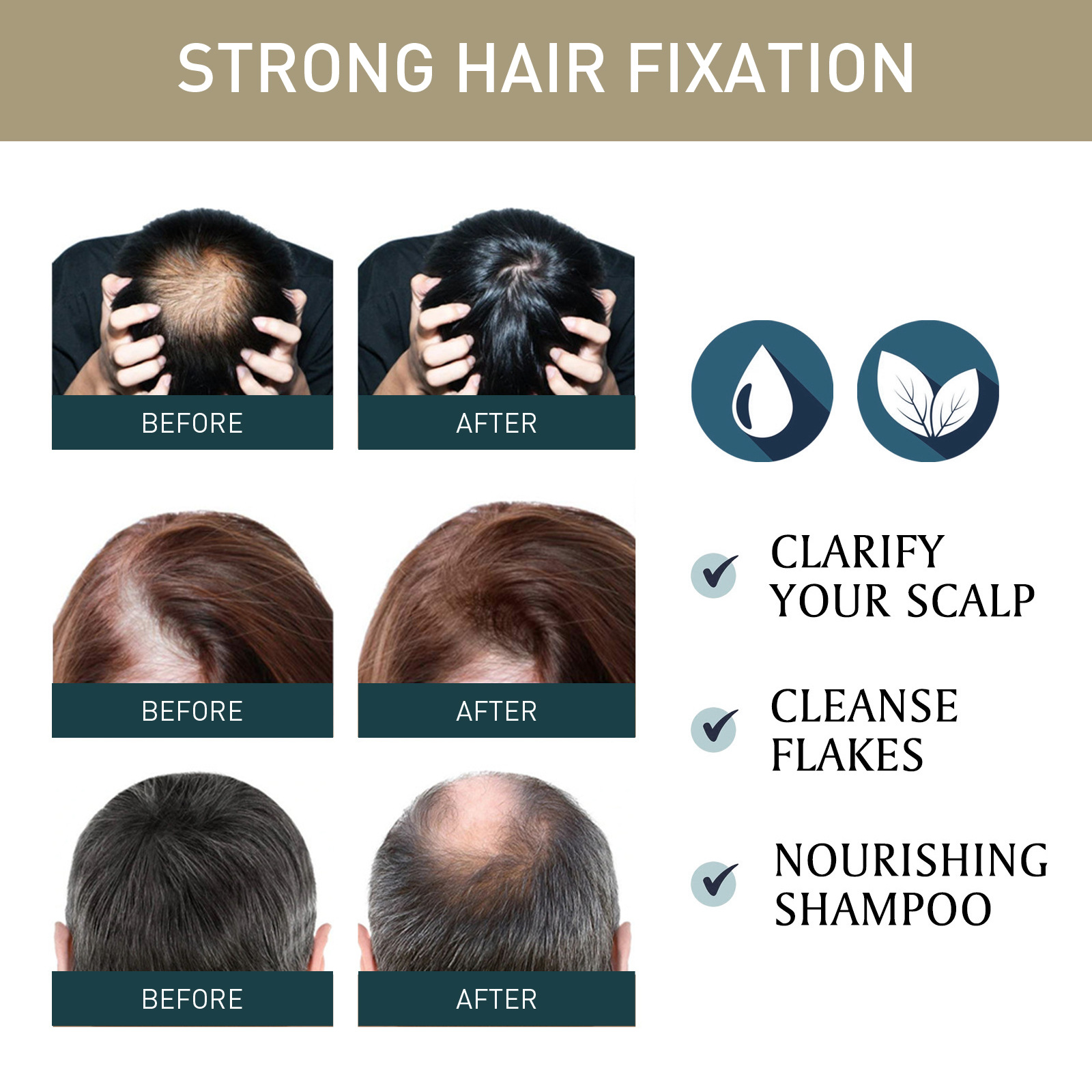 2pcsx100ml Hair Growth Shampoo - đánh giá và giá Hair Care Natural Ingredients