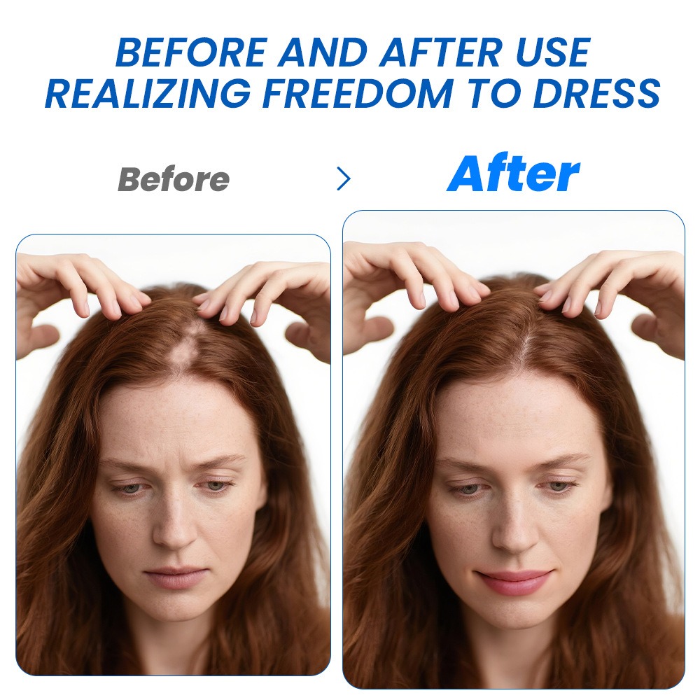 Alopecia Hair Growth Spray Sop - đánh giá và giá Hair Care For Hair Growth