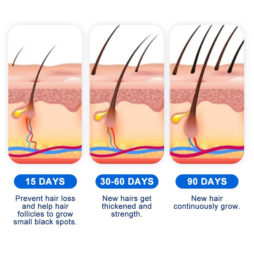 Alopecia Hair Growth Spray Sop - đánh giá và giá Hair Care For Hair Growth