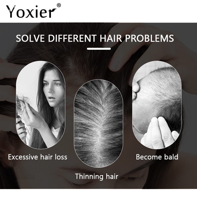 Chuyên Sâu Serum Kích Kem Ngăn - đánh giá và giá Hair Care For Hair Growth