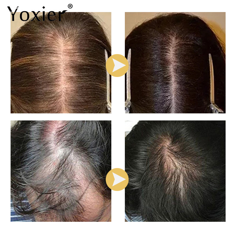 Chuyên Sâu Serum Kích Kem Ngăn - đánh giá và giá Hair Care For Hair Growth