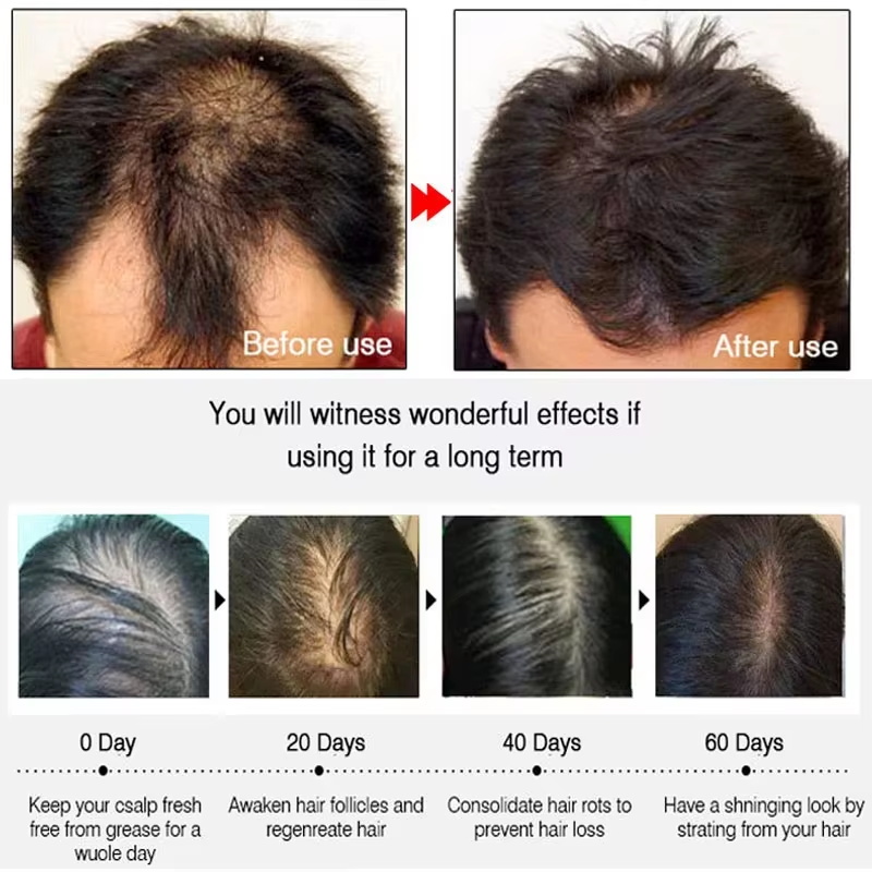 Fast Ginger Hair Growth Spray  - đánh giá và giá Hair Care For Hair Growth