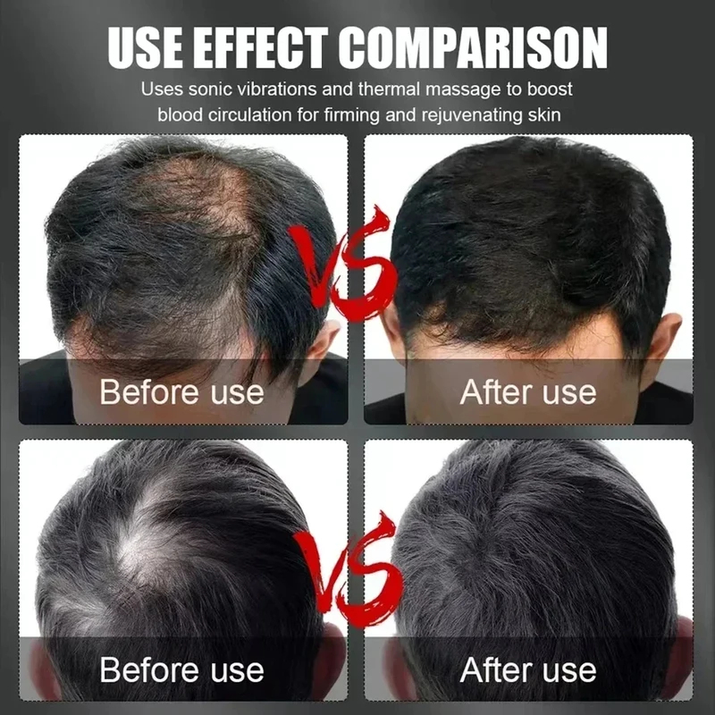 660nm 850nm Red Light Infrared - đánh giá và giá Hair Care For Hair Growth